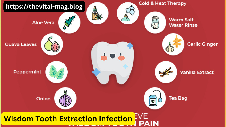 Wisdom Tooth Extraction Infection