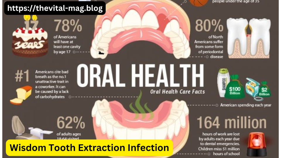 Wisdom Tooth Extraction Infection